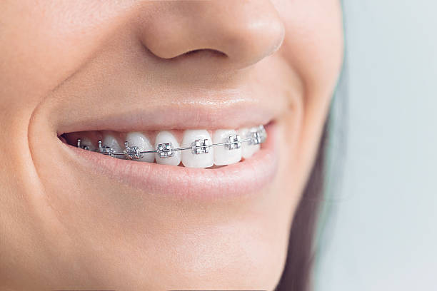 Full Mouth Reconstruction in Ridgeland, SC